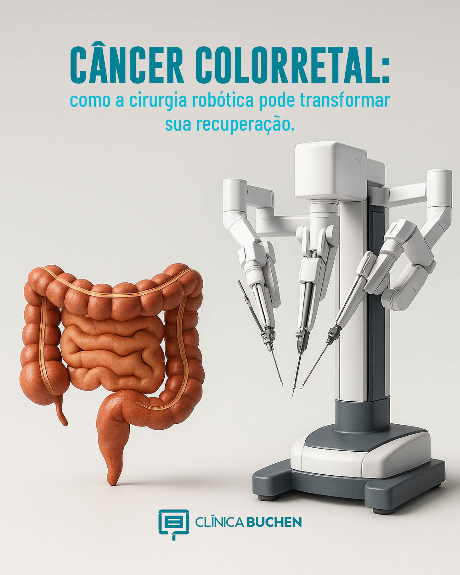 C�ncer Colorretal: como a cirurgia rob�tica pode transformar sua recupera��o