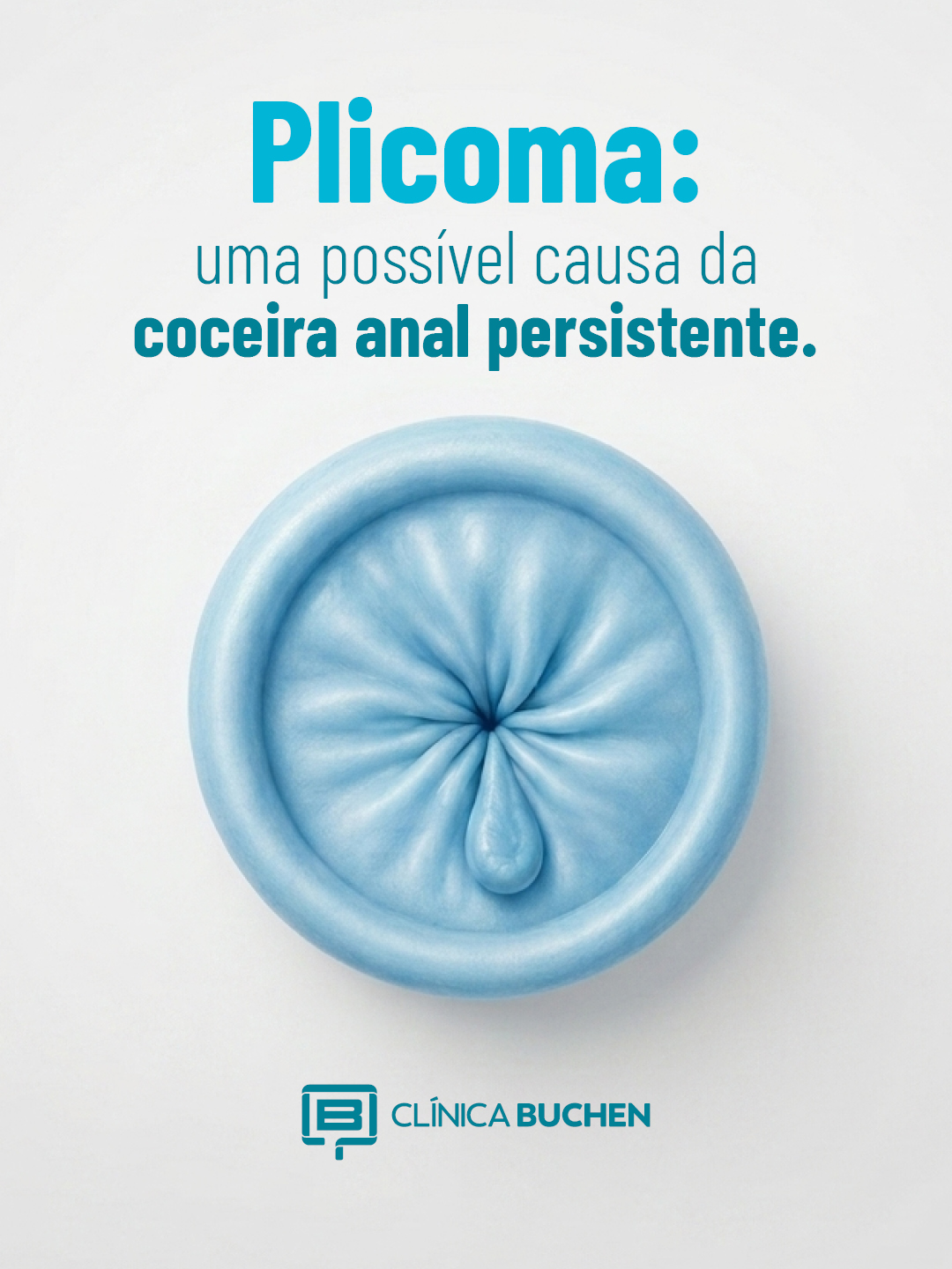 Plicoma: Uma poss�vel causa da coceira anal